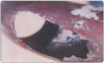 Metal Erosion